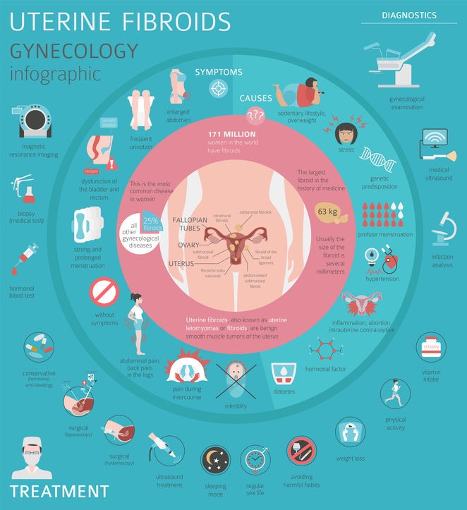 Uterine fibroids